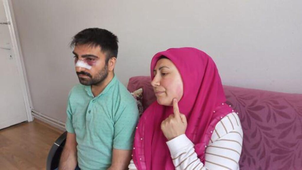 Engelli komşusunun burnunu kırdı, ardından sıcak su döktü