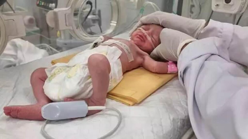 Gazze’de öldürülen annesinin rahminden kurtarılan bebek